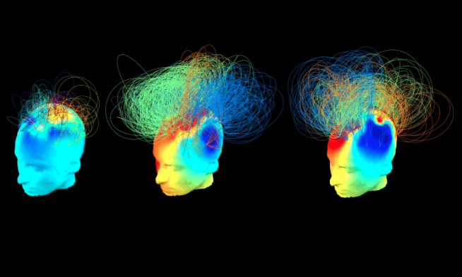 Nuevo estudio advierte que la conciencia es omnipresente en nuestro cerebro